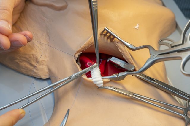 Going with the flow  - procedures in vascular surgery
